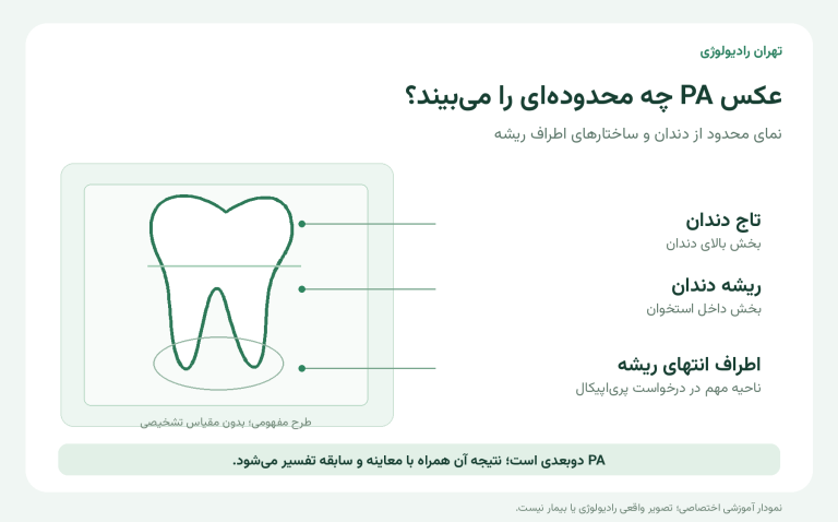 عکس پری‌اپیکال دندان؛ از بررسی ریشه تا پیگیری درمان